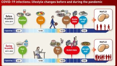 Study: Liver Disease Increases As Result Of Lifestyle Changes Due To Covid-19